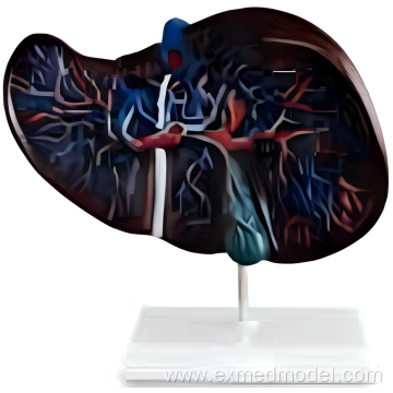 Liver Anatomy Training Model